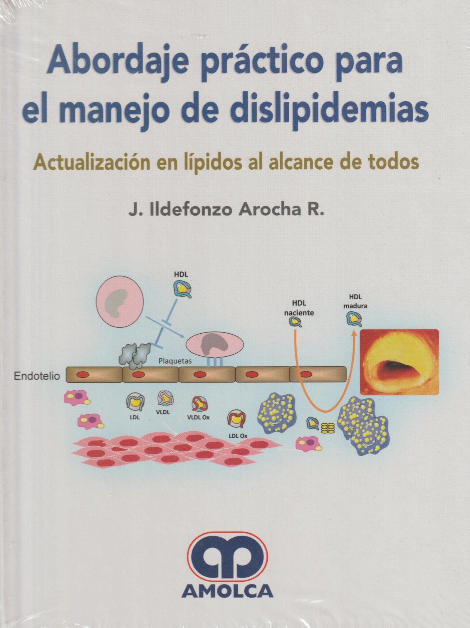 ABORDAJE PRACTICO PARA EL MANEJO DE DISLIPIDEMIAS ACTUALIZACION EN LIPIDOS AL ALCANCE DE TODOS - AROCHA