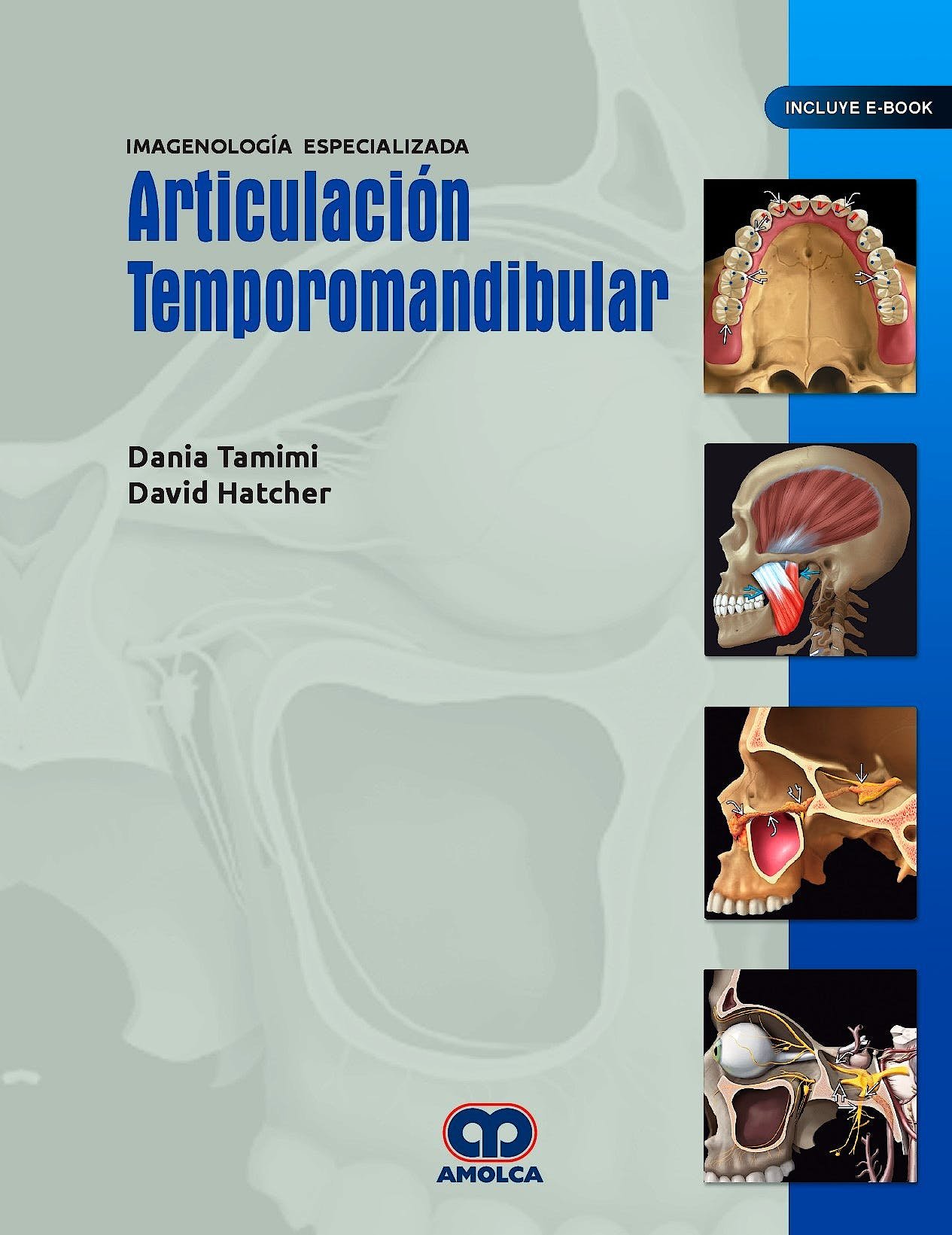 ARTICULACION TEMPOROMANDIBULAR IMAGENOLOGIA ESPECIALIZADA - TAMIMI