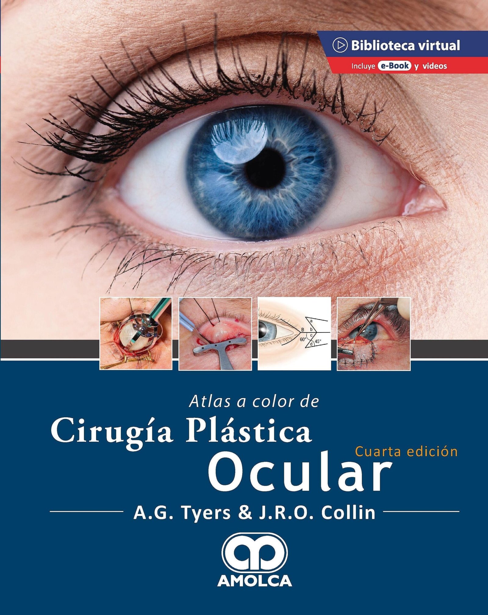 ATLAS A COLOR DE CIRUGIA PLASTICA OCULAR 4ED - TYERS