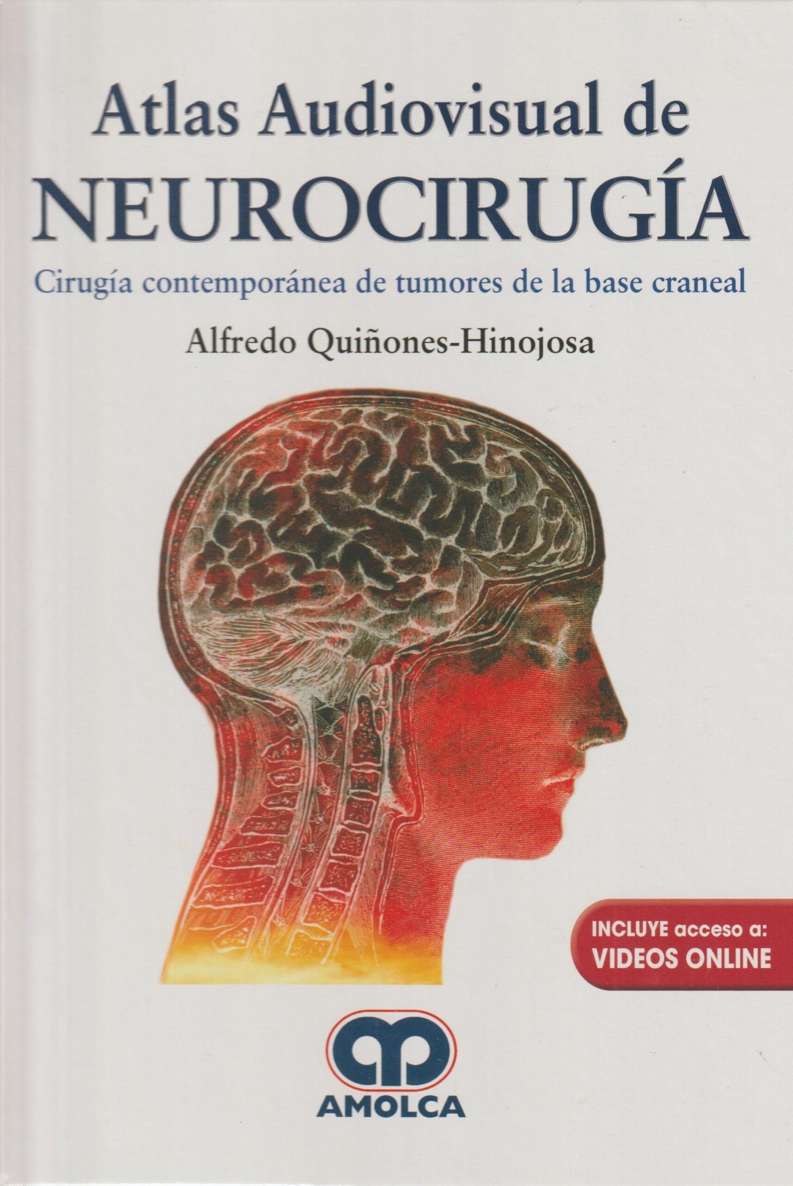 ATLAS AUDIOVISUAL DE NEUROCIRUGIA CIRUGIA CONTEMPORANEA DE TUMORES DE LA BASE CRANEAL - Imagen 2