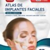 ATLAS DE IMPLANTES FACIALES - YAREMCHUK