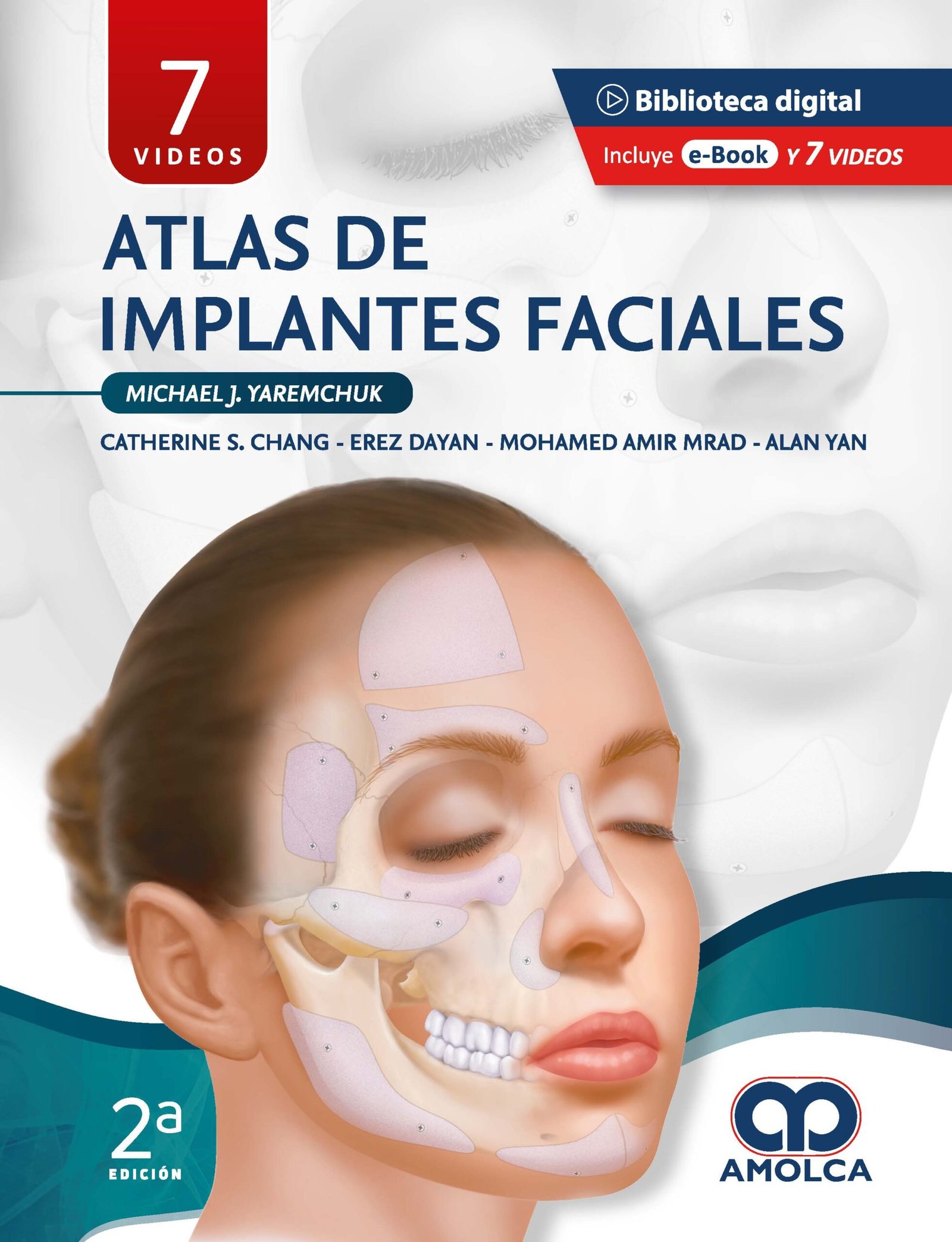 ATLAS DE IMPLANTES FACIALES - YAREMCHUK
