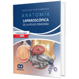 ANATOMIA LAPAROSCOPICA DE LA PELVIS FEMENINA