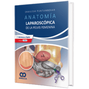ANATOMIA LAPAROSCOPICA DE LA PELVIS FEMENINA