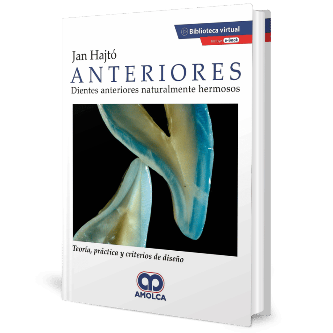 Anteriores dientes anteriores naturalmente hermosos Hajto