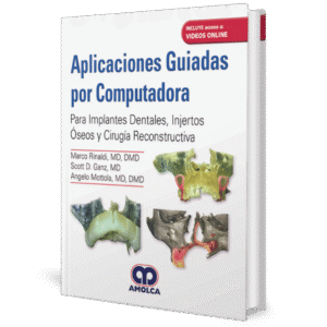 APLICACIONES GUIADAS POR COMPUTADORA PARA IMPLANTES DENTALES INJERTOS OSEOS Y CIRUGIA RECONSTRUCTIVA