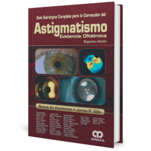GUIA QUIRURGICA COMPLETA PARA LA CORRECCION DEL ASTIGMATISMO EVIDENCIA OFTALMICA 2ED