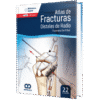 Atlas de Fracturas Distales de radio Del Piñal