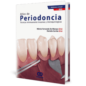 ATLAS DE PERIODONCIA TECNICAS MINIMAMENTE INVASIVAS Y MICROQUIRURGICAS