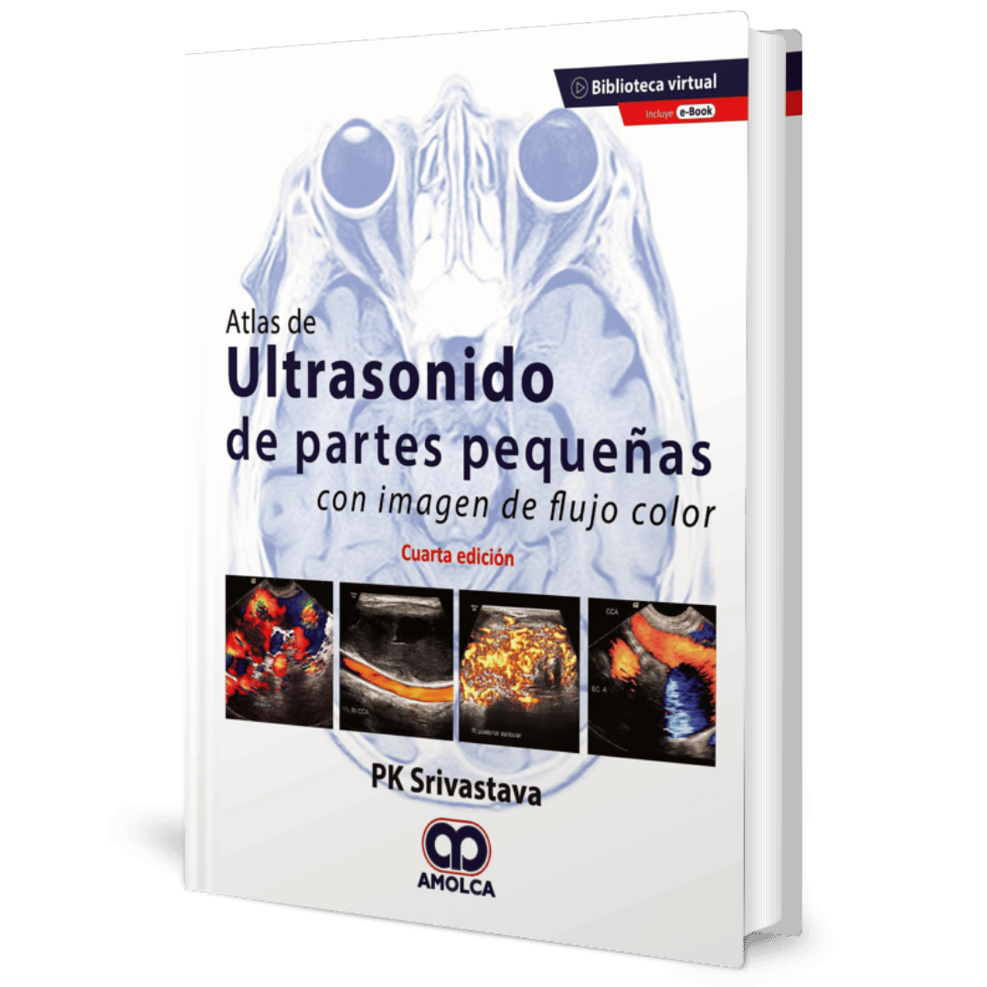 Atlas de ultrasonido de partes pequeñas con imagen de flujo color 4ed Srivastava