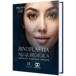RINOPLASTIA NO QUIRURGICA