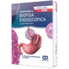 Biopsia Endoscópica Kumarasinghe