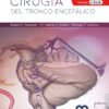 CIRUGIA DEL TRONCO ENCEFALICO - SPETZLER