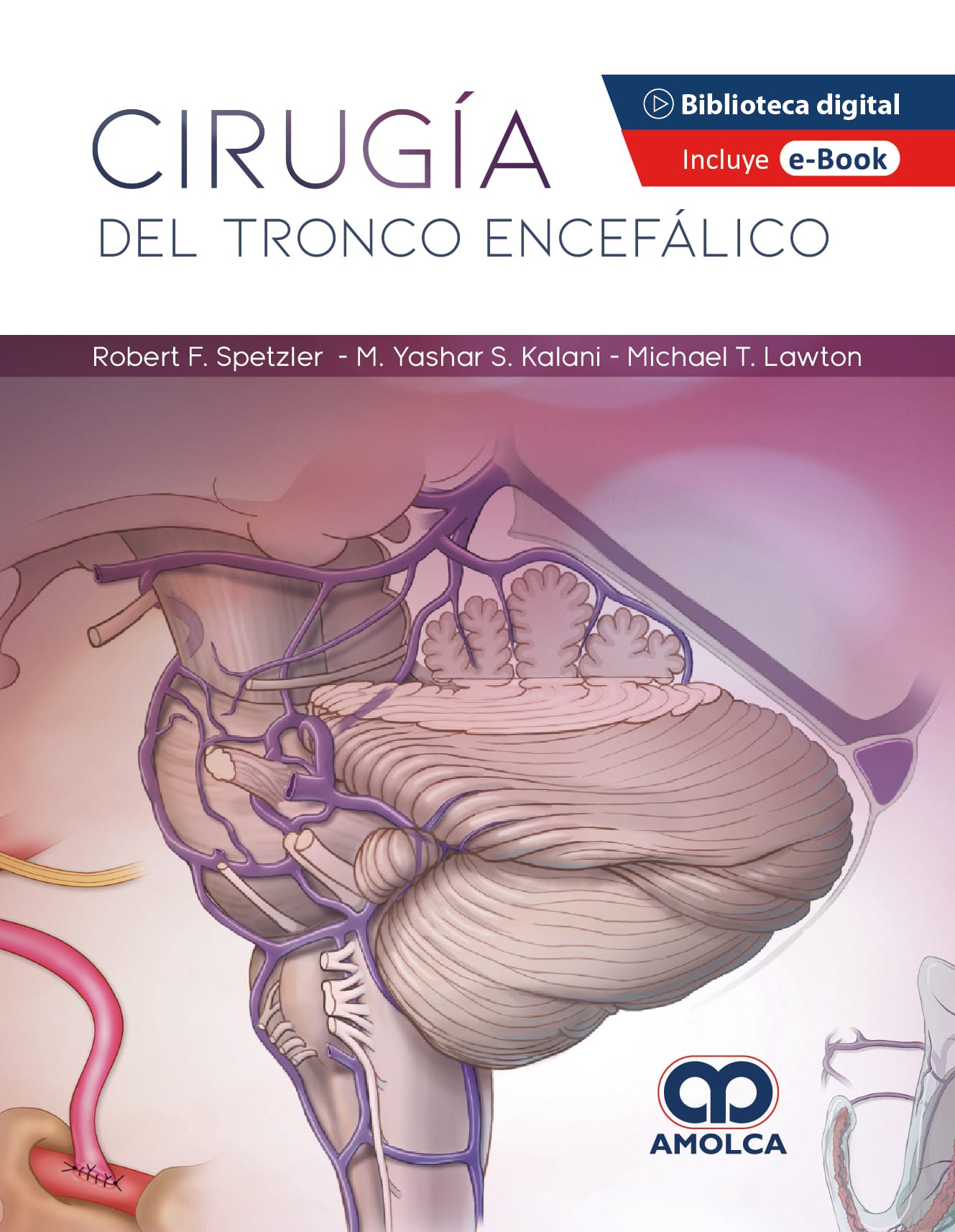 CIRUGIA DEL TRONCO ENCEFALICO - SPETZLER