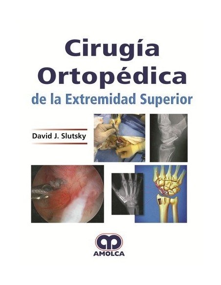 CIRUGIA ORTOPEDICA DE LA EXTREMIDAD SUPERIOR - SLUTSKY
