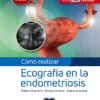 COMO REALIZAR ECOGRAFIA EN LA ENDOMETRIOSIS - Thumbnail Image 2