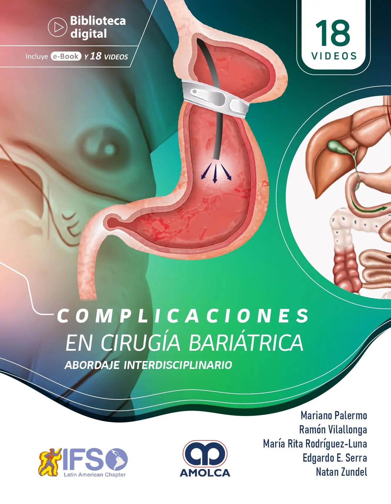 COMPLICACIONES EN CIRUGIA BARIATRICA ABORDAJE INTERDISCIPLINARIO - Imagen 2