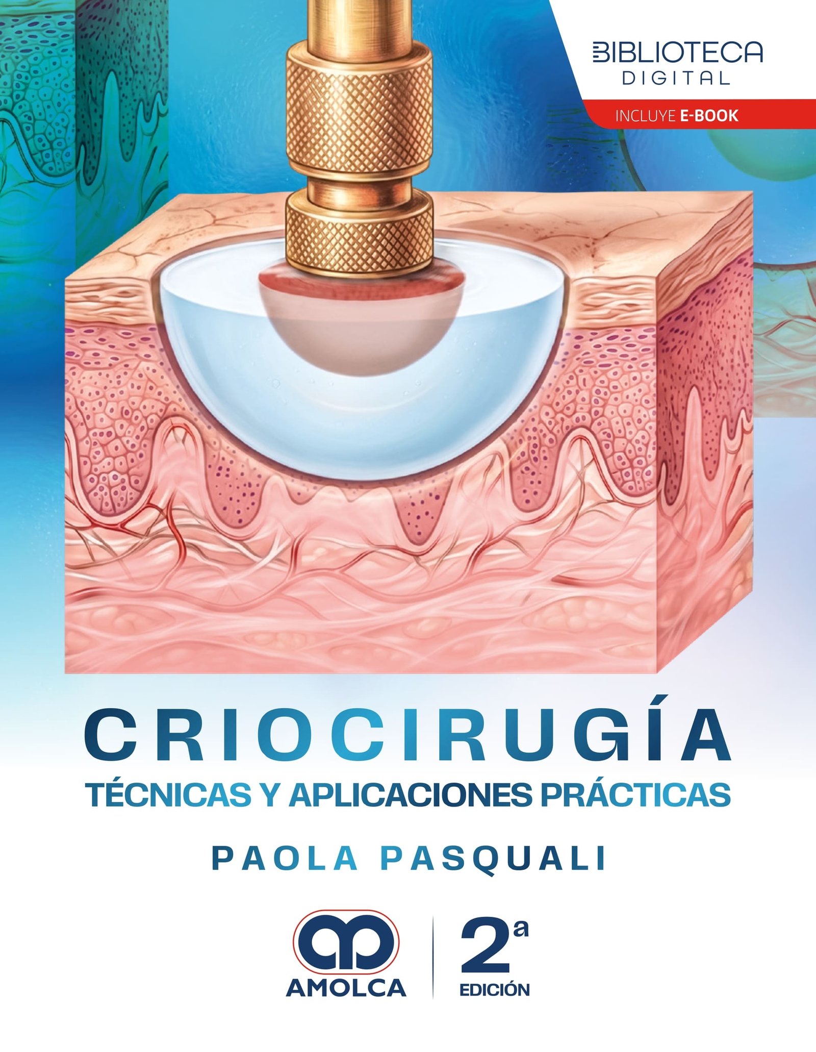 CRIOCIRUGIA TECNICAS Y APLICACIONES PRACTICAS 2ED - Imagen 2