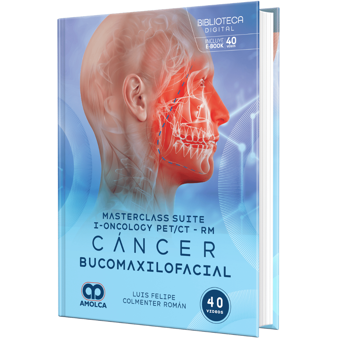 Cancer Buco Colmenter