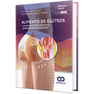 AUMENTO DE GLUTEOS LAS MEJORES PRACTICAS EN EL LEVANTAMIENTO DE GLUTEOS