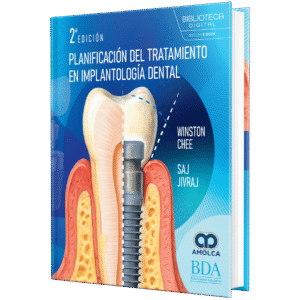 PLANIFICACION DEL TRATAMIENTO EN IMPLANTOLOGIA DENTAL 2ED
