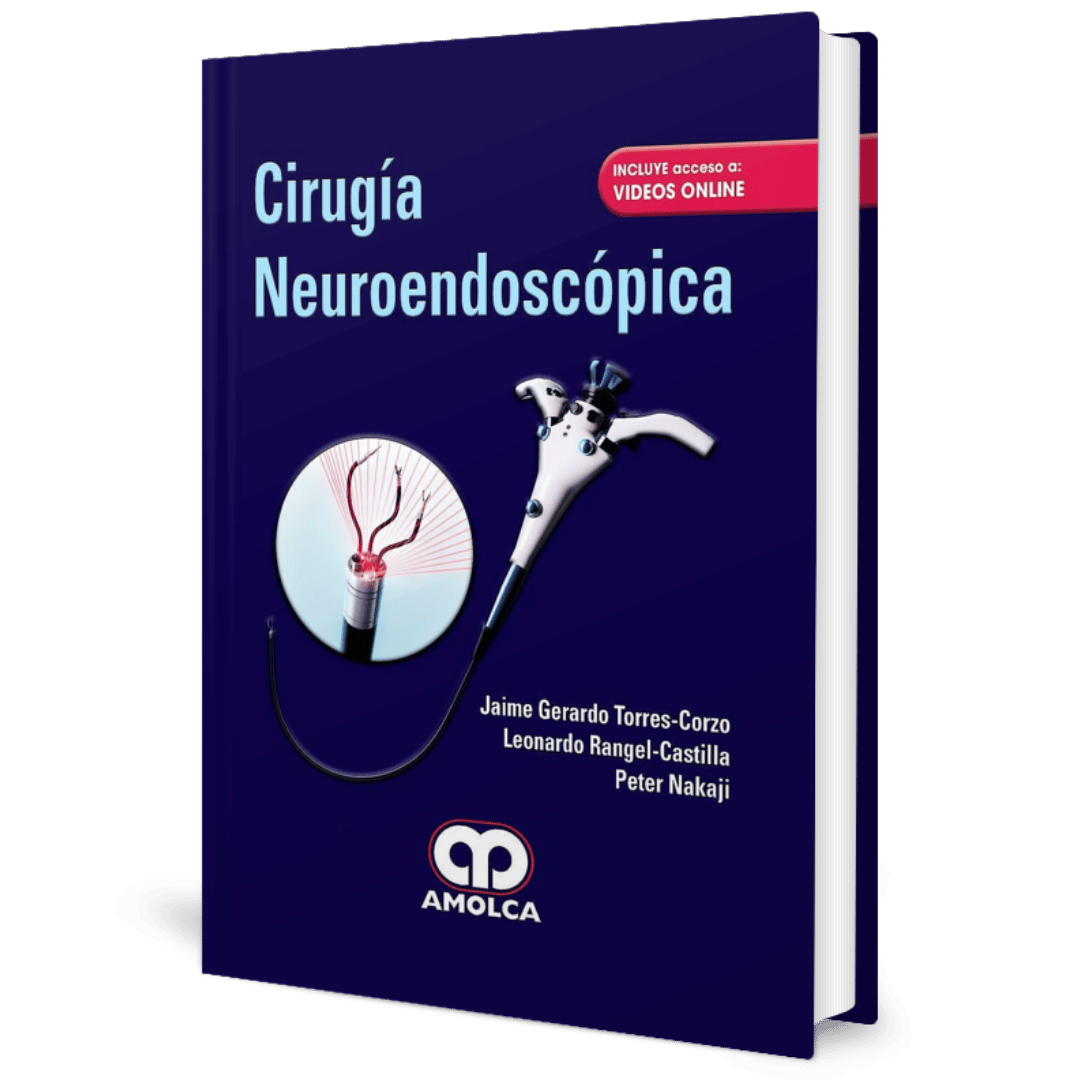 Cirugia Neuroendoscopica Torres-Corzo