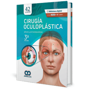 CIRUGIA OCULOPLASTICA 3ED