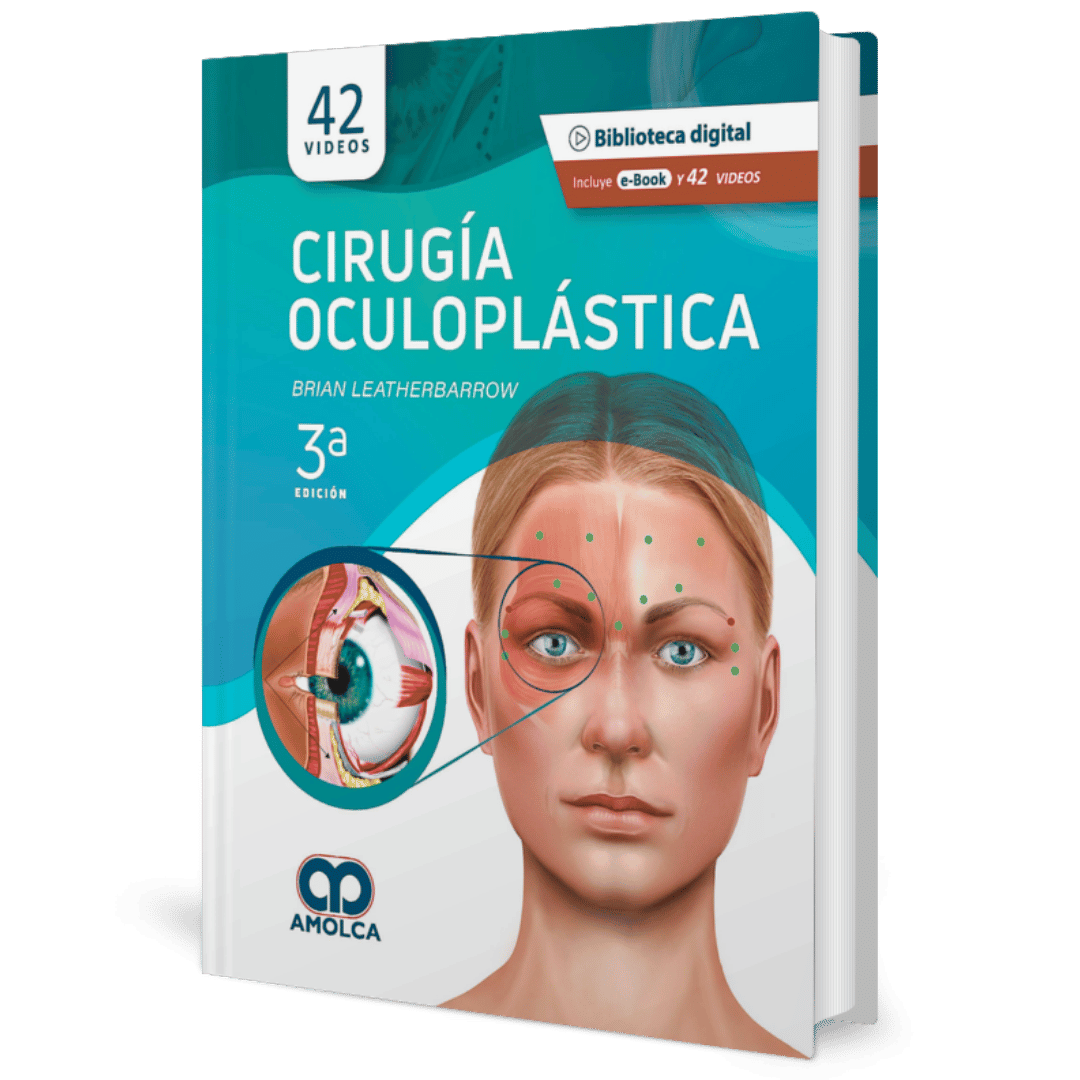 Cirugia Oculoplastica Leatherbarrow
