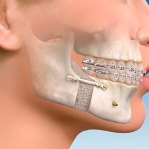 Cirugía Oral y Maxilofacial
