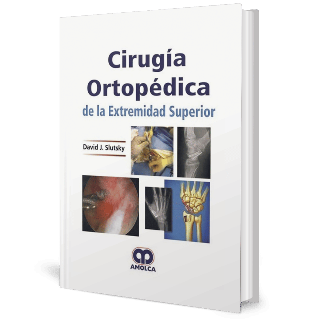 Cirugia Ortopedica de la extremidad superior Slutsky