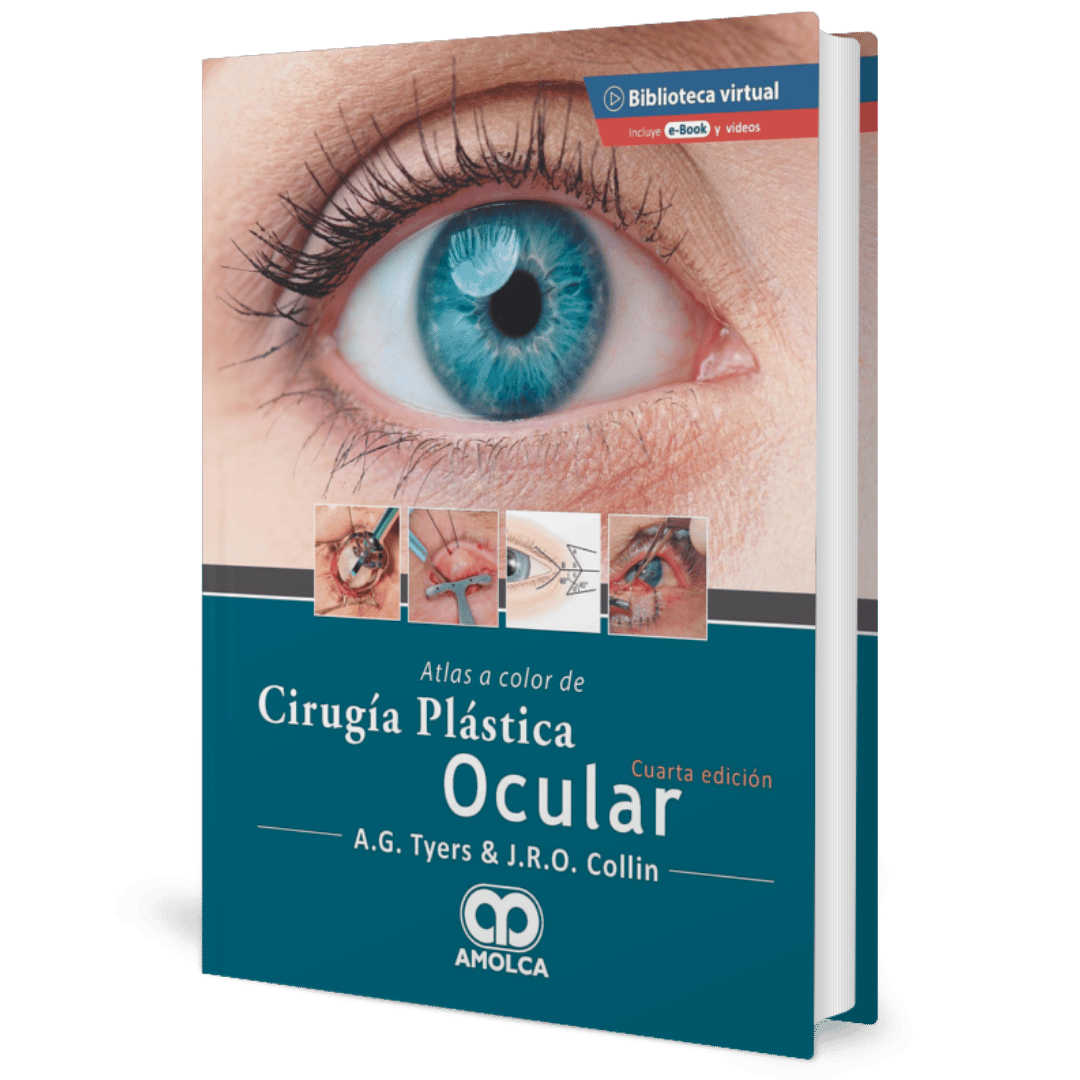 Cirugia Plástica Ocular Tyers