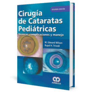 CIRUGIA DE CATARATAS PEDIATRICAS TECNICAS COMPLICACIONES Y MANEJO 2ED