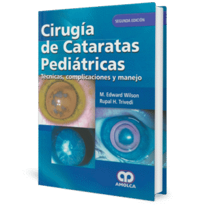 CIRUGIA DE CATARATAS PEDIATRICAS TECNICAS COMPLICACIONES Y MANEJO 2ED