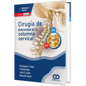 CIRUGIA DE DEFORMIDAD DE LA COLUMNA CERVICAL