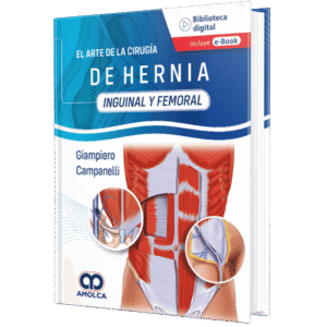 EL ARTE DE LA CIRUGIA DE HERNIA INGUINAL Y FEMORAL