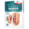 Cirugia de Hernia Ventral e Incisional Campanelli