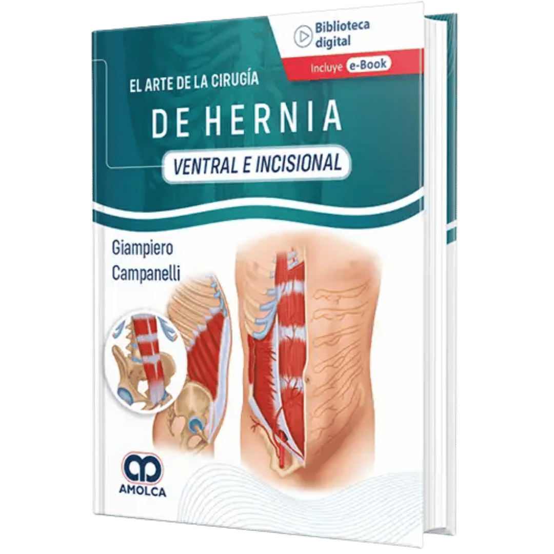 Cirugia de Hernia Ventral e Incisional Campanelli