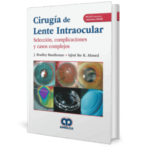 CIRUGIA DE LENTE INTRAOCULAR SELECCION COMPLICACIONES Y CASOS COMPLEJOS