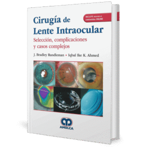 CIRUGIA DE LENTE INTRAOCULAR SELECCION COMPLICACIONES Y CASOS COMPLEJOS