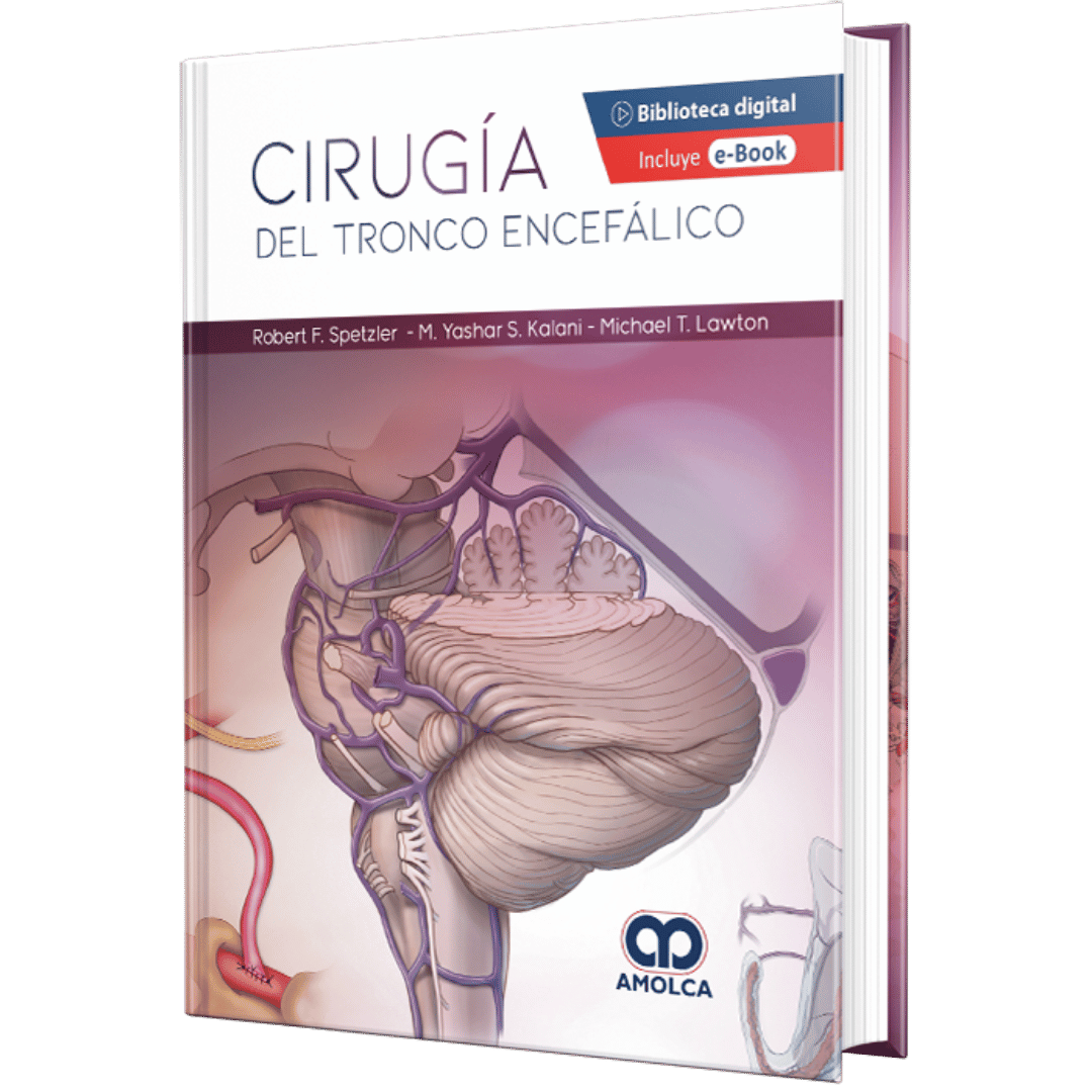 Cirugía del Tronco Spetzler