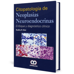 CITOPATOLOGIA DE NEOPLASIAS NEUROENDOCRINAS ENFOQUE Y DIAGNOSTICO CLINICO
