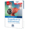 COMO REALIZAR ECOGRAFIA EN LA ENDOMETRIOSIS - Thumbnail Image 1