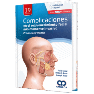 COMPLICACIONES EN EL REJUVENECIMIENTO FACIAL MINIMAMENTE INVASIVO PREVENCION Y MANEJO