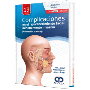 COMPLICACIONES EN EL REJUVENECIMIENTO FACIAL MINIMAMENTE INVASIVO PREVENCION Y MANEJO