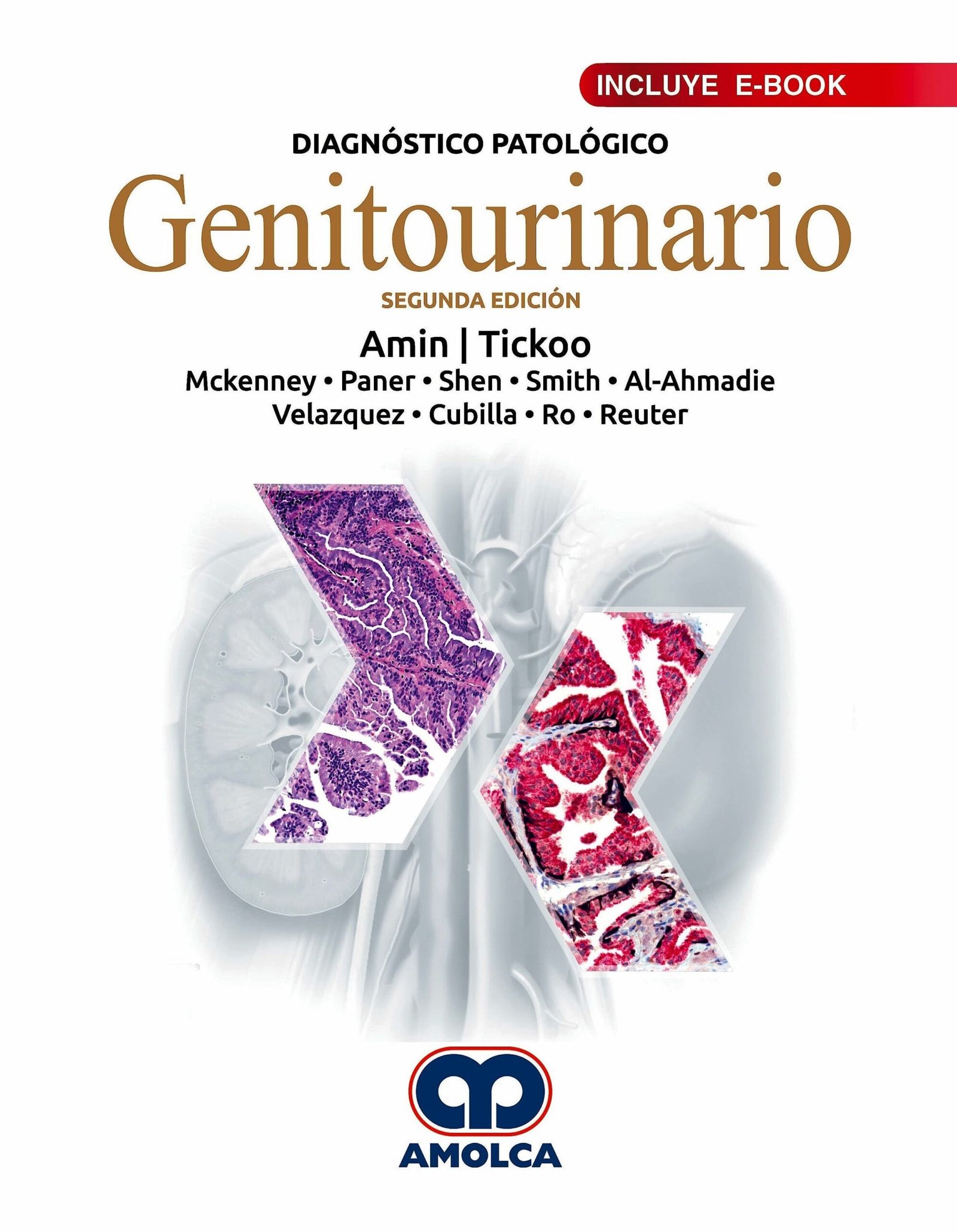 DIAGNOSTICO PATOLOGICO GENITOURINARIO 2ED - AMIN