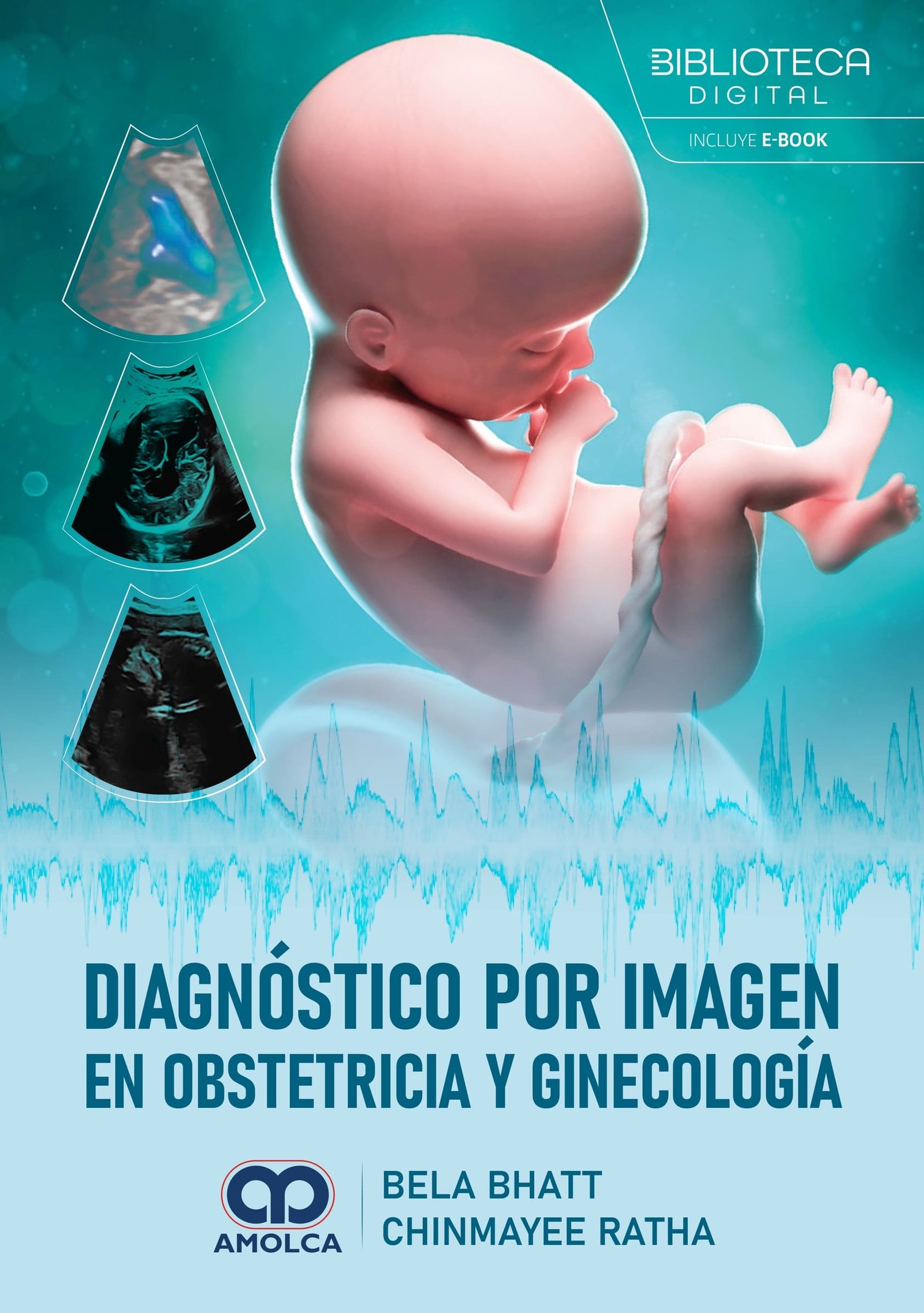 DIAGNOSTICO POR IMAGEN EN OBSTETRICIA Y GINECOLOGIA - Imagen 2