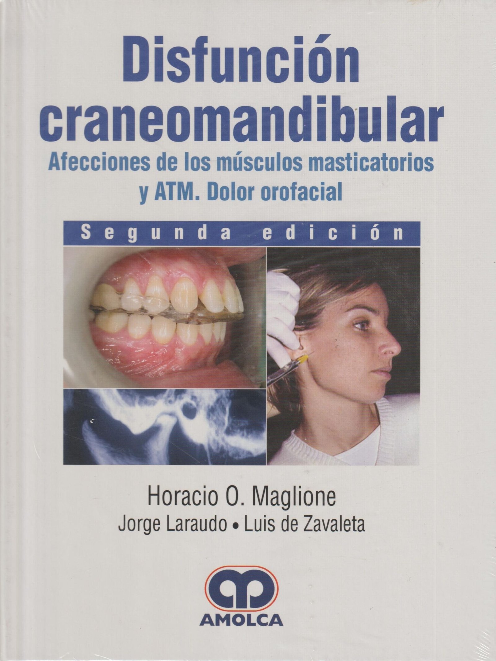 DISFUNCION CRANEOMANDIBULAR AFECCIONES DE LOS MUSCULOS MASTICATORIOS Y ATM. DOLOR OROFACIAL 2ED - MAGLIONE