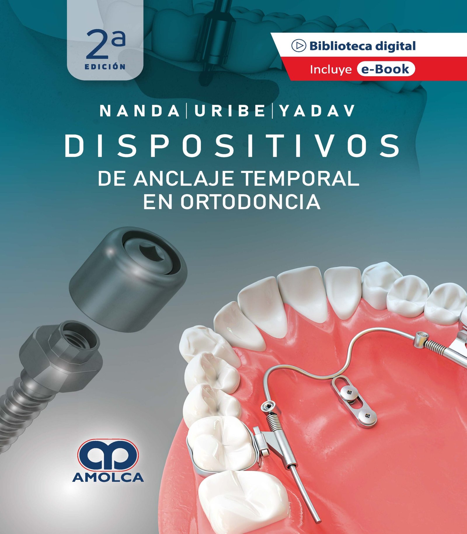DISPOSITIVOS DE ANCLAJE TEMPORAL EN ORTODONCIA - NANDA
