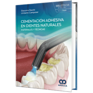 CEMENTACION ADHESIVA EN DIENTES NATURALES MATERIALES Y TECNICAS