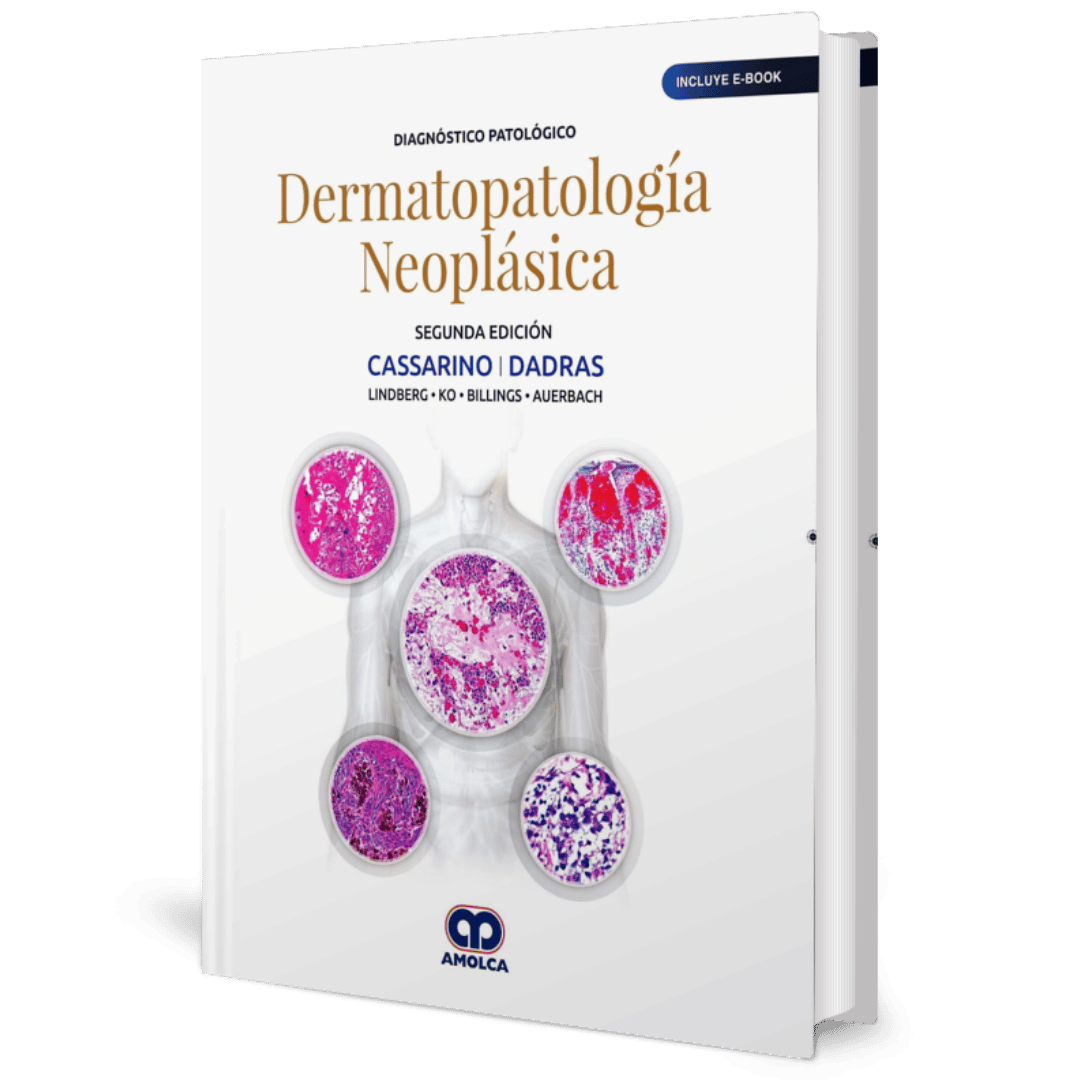 Diagnostico Patologico Dermatopatologia Neoplastica 2ed Cassarino